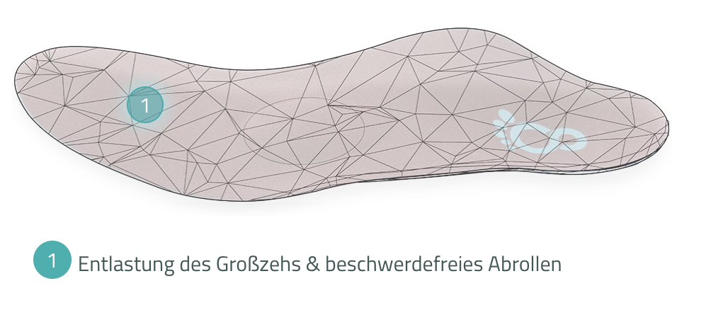 Orthopädische Masseinlage von Cordewener bei Hallux Rigidus zur Entlastung des Grosszehengrundgelenks