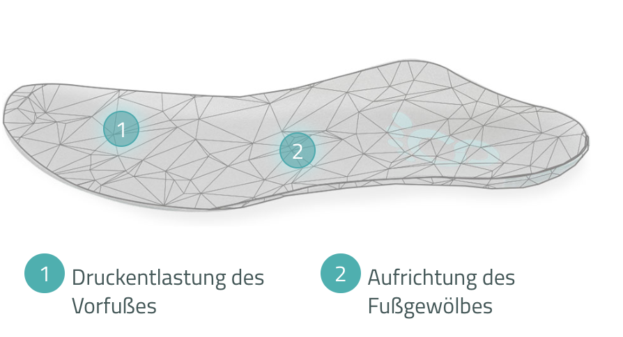 Einlage mit Druckentlastungspunkten
