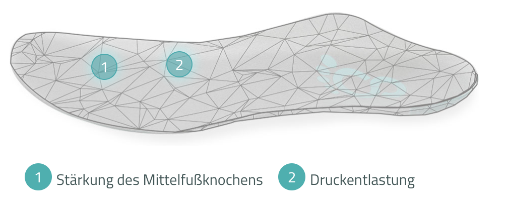 Orthopädische Masseinlage von Cordewener bei Hallux Valgus zur Druckentlastung des Mittelfussknochens