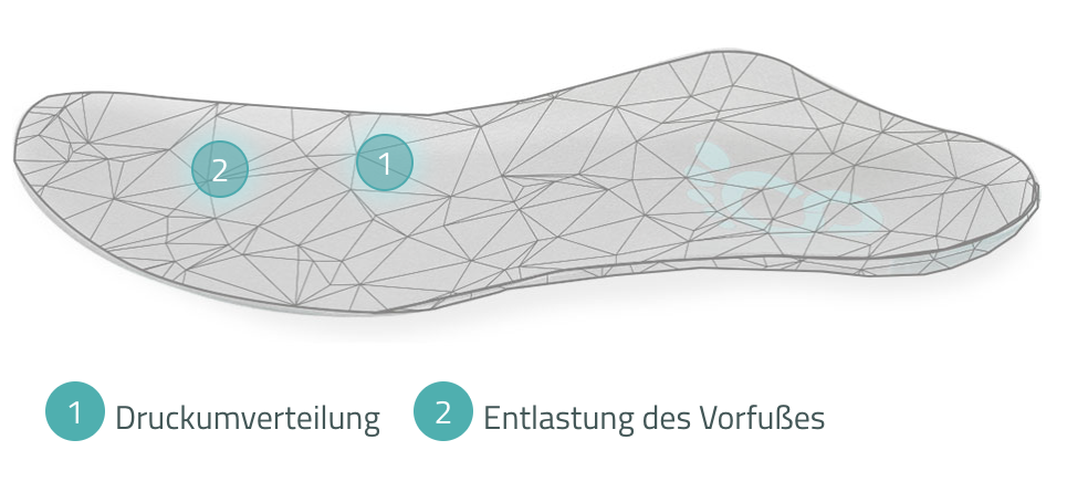 Custom orthopaedic insole by Cordewener for metatarsalgia and Morton's neuroma, relieving the forefoot